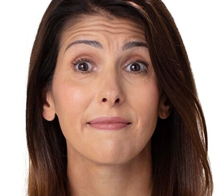 Botox Treatment Result 1 - Before